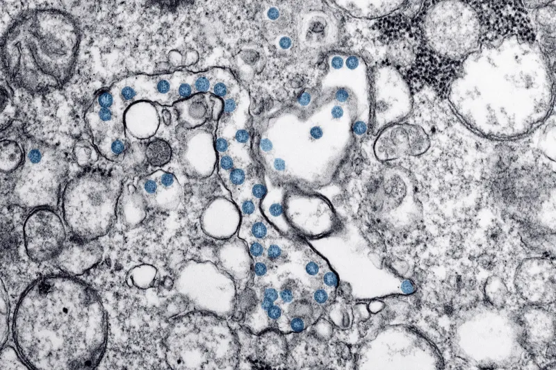 The Silent Buffer: Understanding Mitochondrial Reserve Capacity and Why Energy Collapse Arrives Without Warning